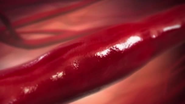 Curación Oclusión Vascular Animación Médica — Vídeo de stock