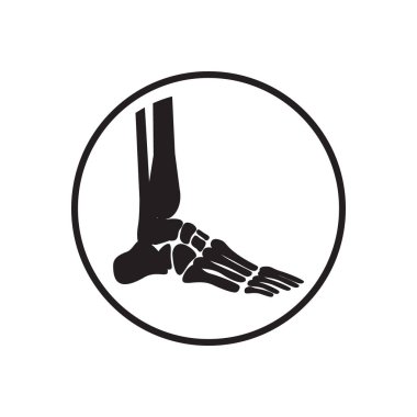 Artrit ikonu. Osteopat pratiği. Osteoporoz işareti, osteoartrit anatomik vektörü. Omurga ağrısı, omurgalar arası fıtık beyaz arka planda gösteriliyor. İniş sayfası, ağ, uygulama için..