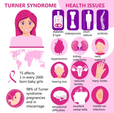 Turner Sendromu bilgi vektörü. İşaretler, sağlık sorunları. Boyu kısa, böbrek düzensizliği, doğurganlık azalması, bir sürü ben, osteoporoz ve diyabet başlıca sorunlardır. Ts farkındalık ayı.
