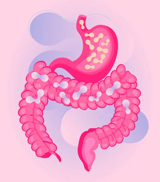L'estomac et l'intestin sont infectés par des bactéries probiotiques, le lactobacille. Soins de santé, immunité supp — Image vectorielle