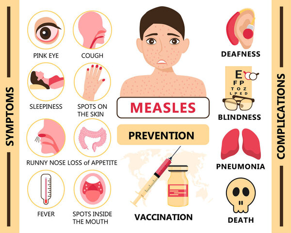 Measles infographic concept vector. Infected human with papules on the skin. Rubeola symptoms and complications illustration. Agitation of vaccination and prevention of measles for medical website.
