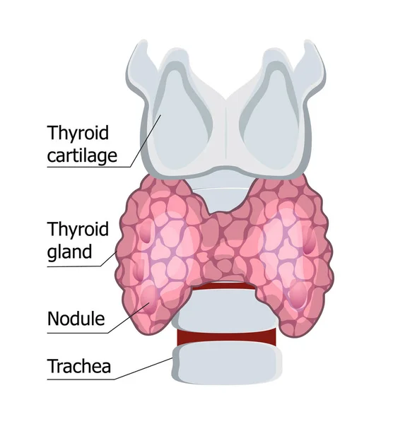 Glándula Tiroides Humana Aislada Fondo Blanco Hipotiroidismo Vector Concepto Endocrinología — Vector de stock