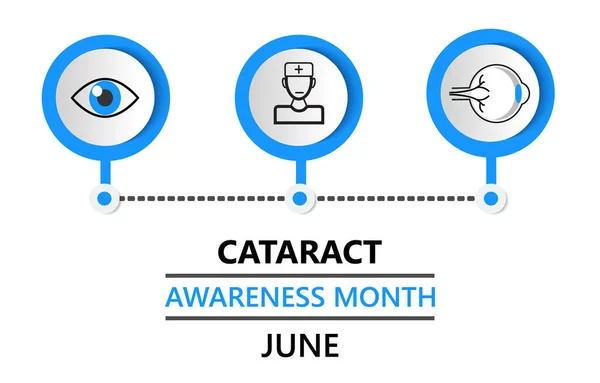 El mes de la conciencia de cataratas se celebra en junio. Enfermedad del glaucoma y problemas de nefropatía. Ilustración conceptual oftalmológica. Comprobación de la vista con el carácter diminuto de la gente para la tela . — Vector de stock