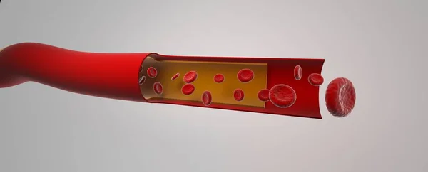 Atardamarda kırmızı kan, eritrositlerle dilimlenmiş kan damarı.
