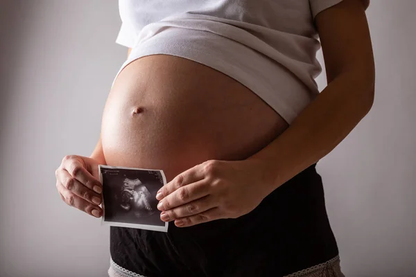 Zwangere vrouw kijkt naar echografie foto in een studio — Stockfoto