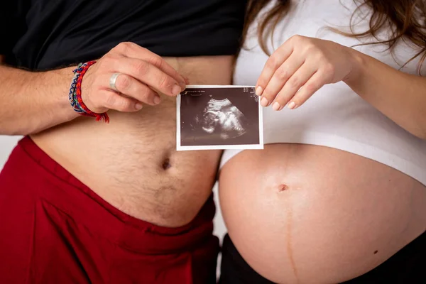 Счастливая супружеская пара показывает тест на беременность и ультразвуковое изображение их нерожденного ребенка. Сосредоточьтесь на двух полосах — стоковое фото
