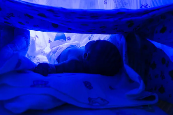 인큐베이터에서 자외선 아래 황달 치료를 받고 있는 갓난아기 — 스톡 사진