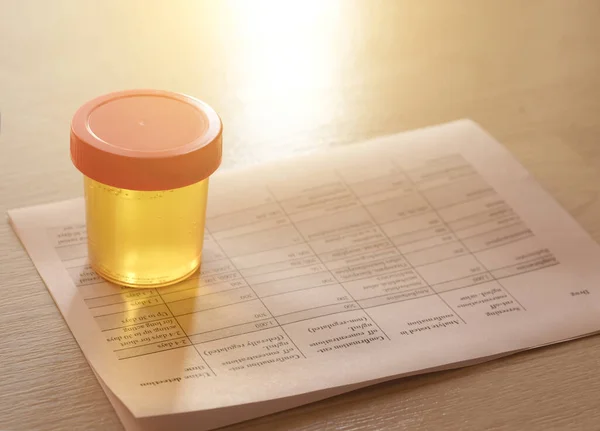 Urinalysis, Drug Testing, Drug. Plastic jars for medical tests.. Urine test — Stock Photo, Image