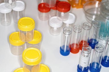 Araştırma laboratuvarında test tüplerinde bir sürü test tüpü çalışma ve araştırma için sembolik bir fotoğraf..