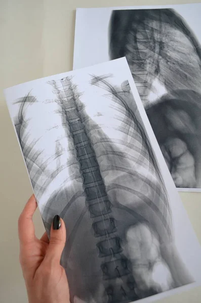 Imagem da coluna vertebral - exame de diagnóstico — Fotografia de Stock