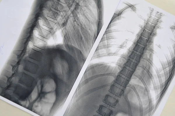 Rengen spine picture - diagnosis examination — Stock Image Rengen spine picture - diagnosis examination Stock Image