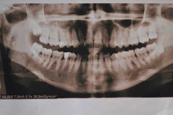 Panoramik resim supercomplete diş. x-ışını — Stok fotoğraf