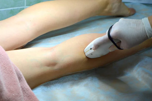 Depilazione Laser Depilazione Sulle Gambe — Foto Stock