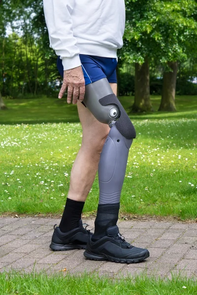 Homem com perna falsa — Fotografia de Stock