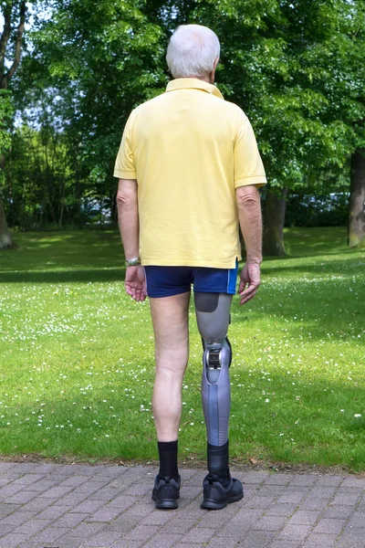 Mężczyzna z protezą nogi — Zdjęcie stockowe