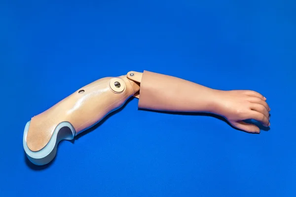 Einarmiger prothetischer Arm — Stockfoto