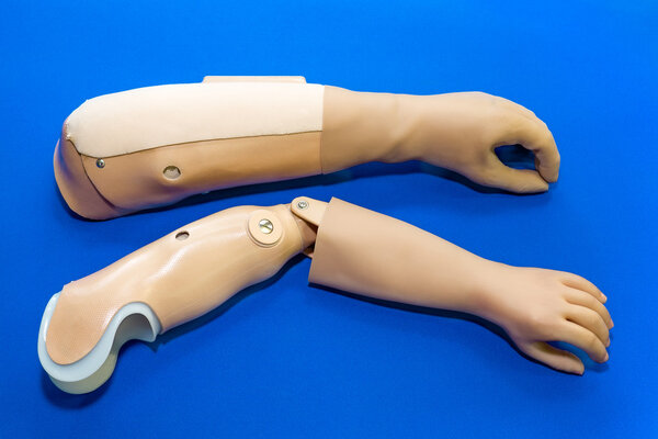 Pair of prosthetic arms 