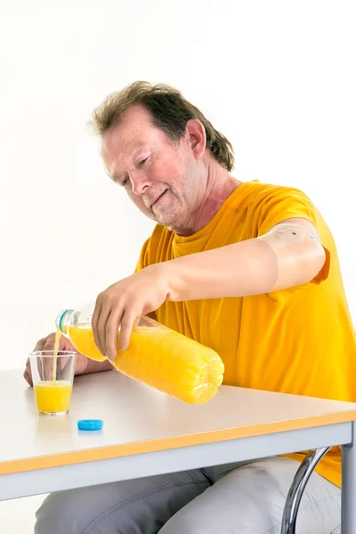 Mann mit bionischer Handprothese — Stockfoto