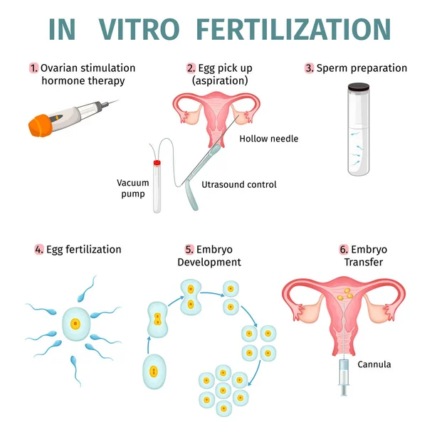 Conceito de fertilização in vitro —  Vetores de Stock