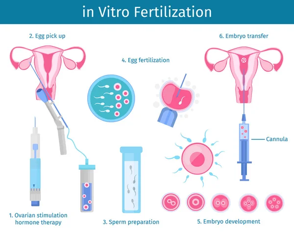 Conceito do Processo de Fertilização In Vitro —  Vetores de Stock