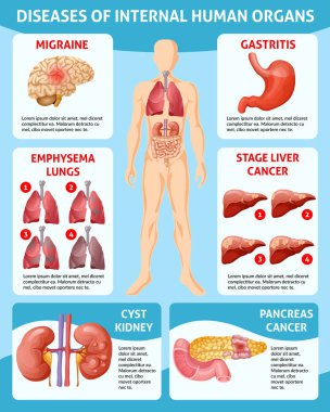 Karikatür tıbbi bakım Infographic kavramı
