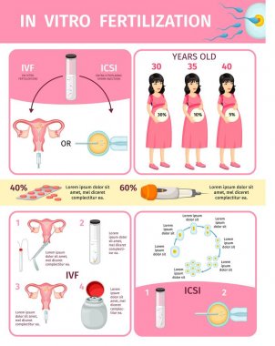 İn vitro fertilizasyon Infographic kavramında