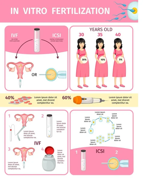 İn vitro fertilizasyon Infographic kavramında — Stok Vektör