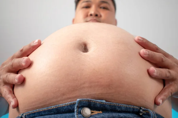超重男人的胃 肚子肥 — 图库照片