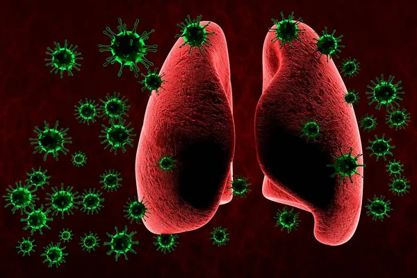 의학적 코로나 바이러스 Coronavirus Covid 중국에서 호흡기 인플루엔자 바이러스 — 스톡 사진