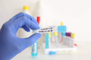 covid-19 Coronavirus grip test tüpü aşı ile biyoteknoloji araştırma laboratuvarında