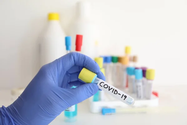 Coronavirus Covid Test Tube Laboratory — Stock Photo, Image