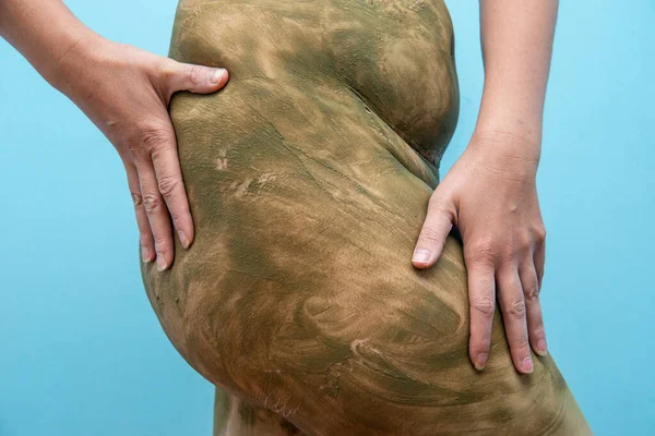 Tratamiento Eliminación Celulitis Cuidado Tratamiento Piel Primer Plano Retrato Joven — Foto de Stock