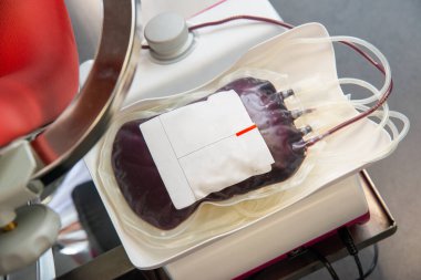 Kan nakli. Laboratuvarda kırmızı kan torbası. Kan bağışı, kan nakli..