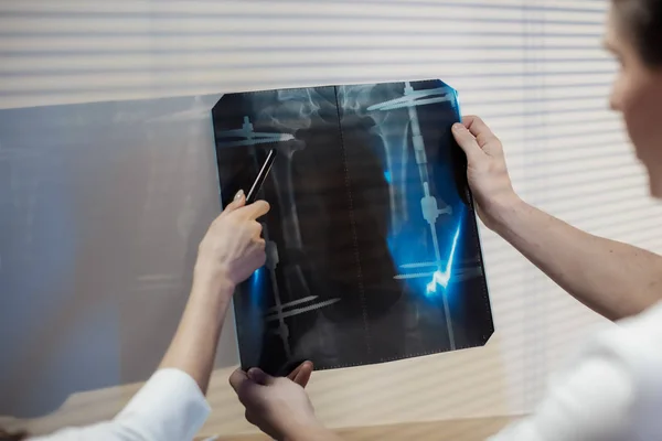 Zwei Ärzte untersuchen das Röntgenbild. Arzt bespricht mit dem Mann die Diagnose. — Stockfoto