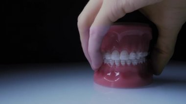 Close-up of teeth with transparent braces. The jaw with braces turns on the surface.