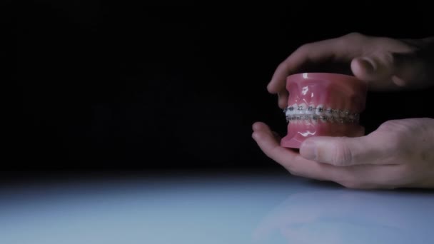 用金属矫形器对牙齿进行近距离观察。 手拿着大括号的下颌骨的展示. — 图库视频影像