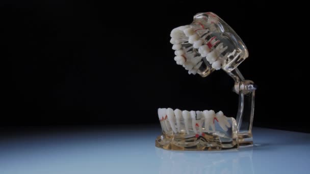 Крупный план зубов с примерами дефектов и плохих зубов — стоковое видео
