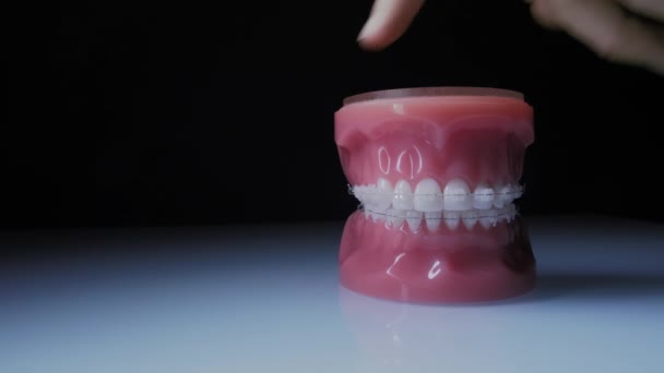 Primer plano de los dientes con frenos transparentes. La mandíbula con frenos gira sobre la superficie . — Vídeos de Stock