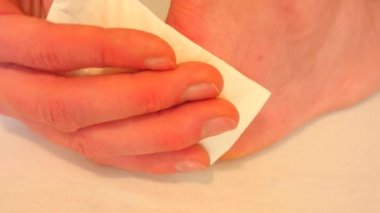 Kurutma ve temizlik el topuk ile doku üzerinde kanlı blister kırık. Kanlı ve ıslak yırtık deri ile acı bir yer deri saçları ile yara. Temiz yara merhemi şifa bir beyaz ile tedavi edilir