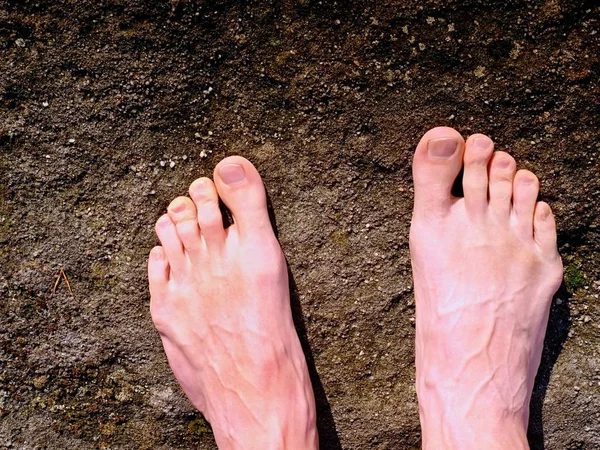 Naked male legs on peak make step. Sandstone rock above valley with tired hikers legs. — Stock Photo, Image