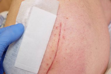 Doktor elini sıva cilt Kalça eklemi cerrahisi kontrol etmek için. 