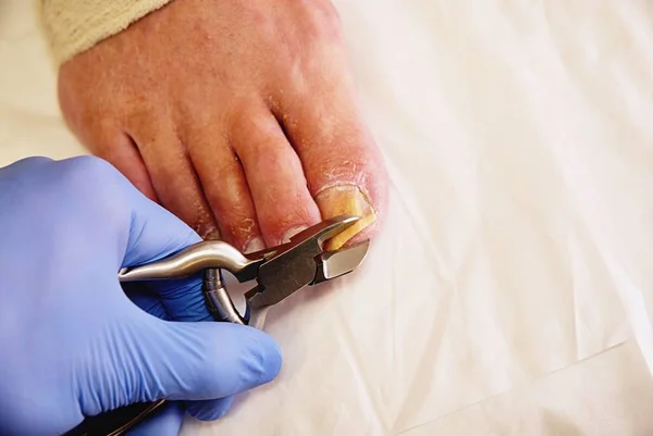 Primer plano de una manicura con alicates de pedicura recortando las uñas de los pies de las personas mayores . — Foto de Stock