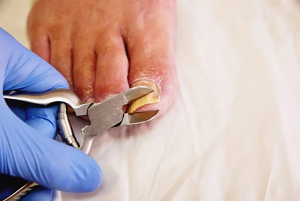 Крупный план маникюрши с плоскогубцами для педикюра, стригущего ногти пожилого человека . — стоковое фото