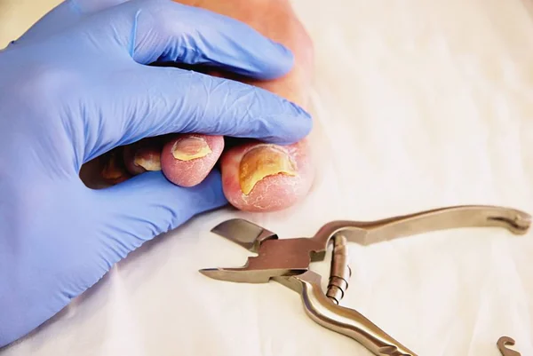 Close-up de uma manicure com alicate de pedicure cortando a unha da pessoa idosa . — Fotografia de Stock