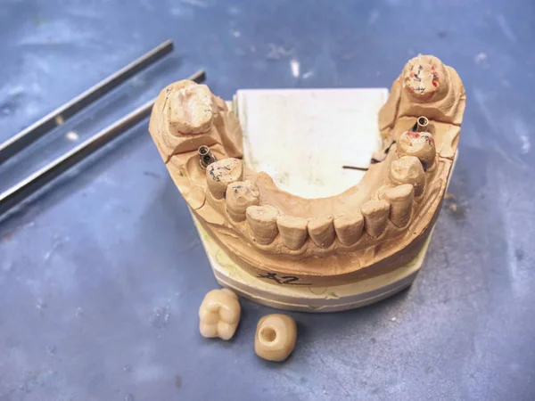 Sharpened  and polished tooth model on dental construction — ストック写真