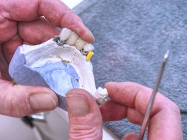 Laboratuvardaki masanın üzerinde diş aletleri var. Ortodonti teknisyeni