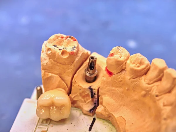 Diş laboratuarındaki teknik çekimler. Dişçi işi. — Stok fotoğraf