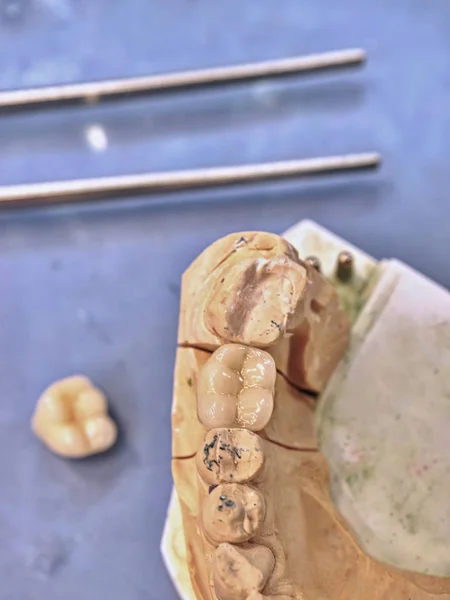 Molde de gesso de mandíbulas humanas. Mandíbulas modelo de gesso de fundição dentária — Fotografia de Stock