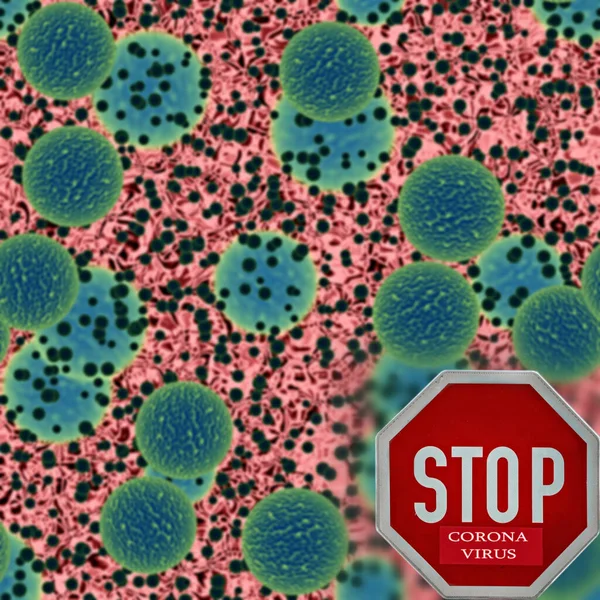 Rotavirus in tested biological liquid.  Coronavirus