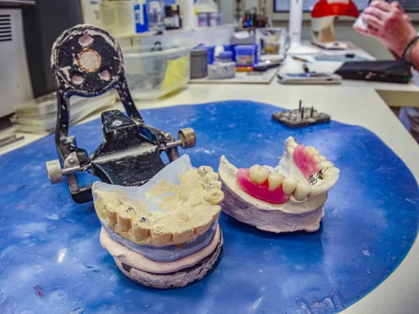 Przegubowy Gips Dentystyczny Stole Laboratorium Stomatologicznym Stół Roboczy Protez Sztuczne — Zdjęcie stockowe